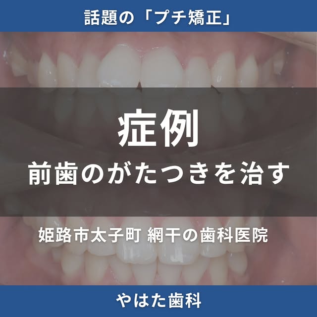 インスタグラム・当院からのお知らせ